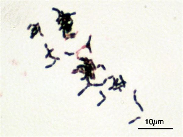 Bifidobacterium adolescentis Gram