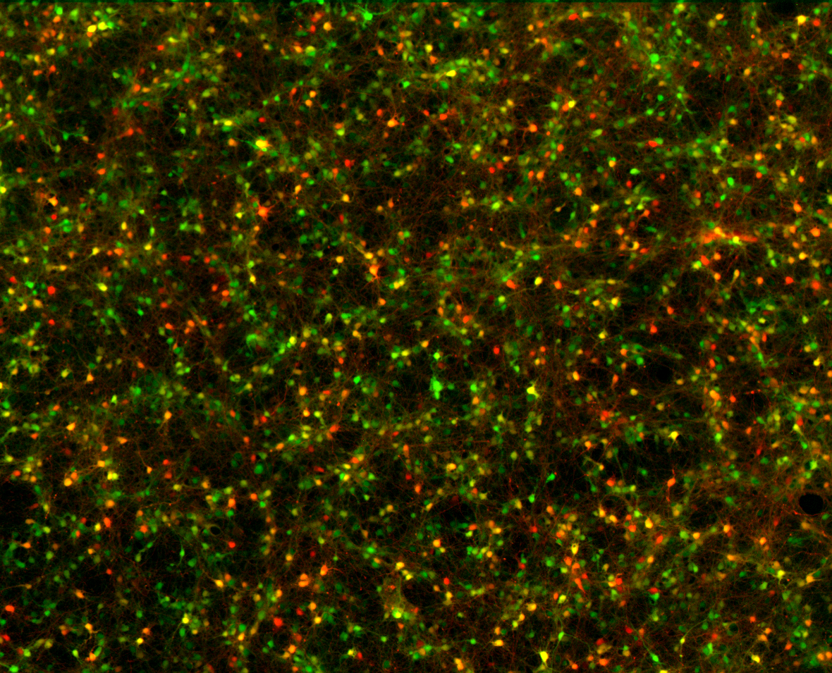 File:Synapsin and CamK2 positive neurons.png
