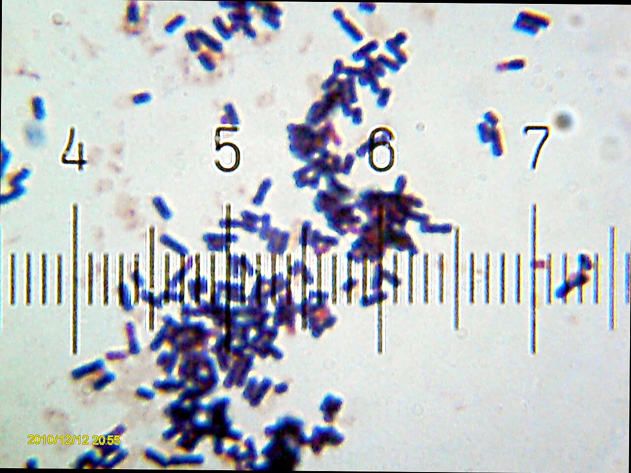 Lactobacillus acidophilus from a commercially-sold nutritional supplement tablet. 100× objective, 15× eyepiece; numbered ticks are 11 µM apart. Gram stained. The scale of the full-